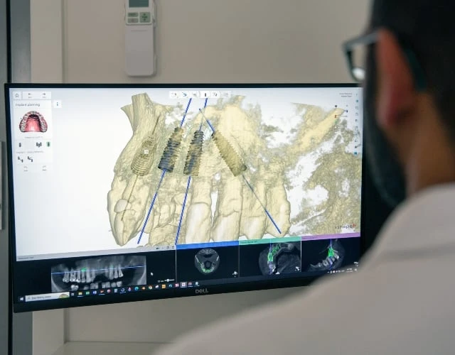 All-teeth-on-implants Nearby Warragul, Gippsland In Warragul Dental Care