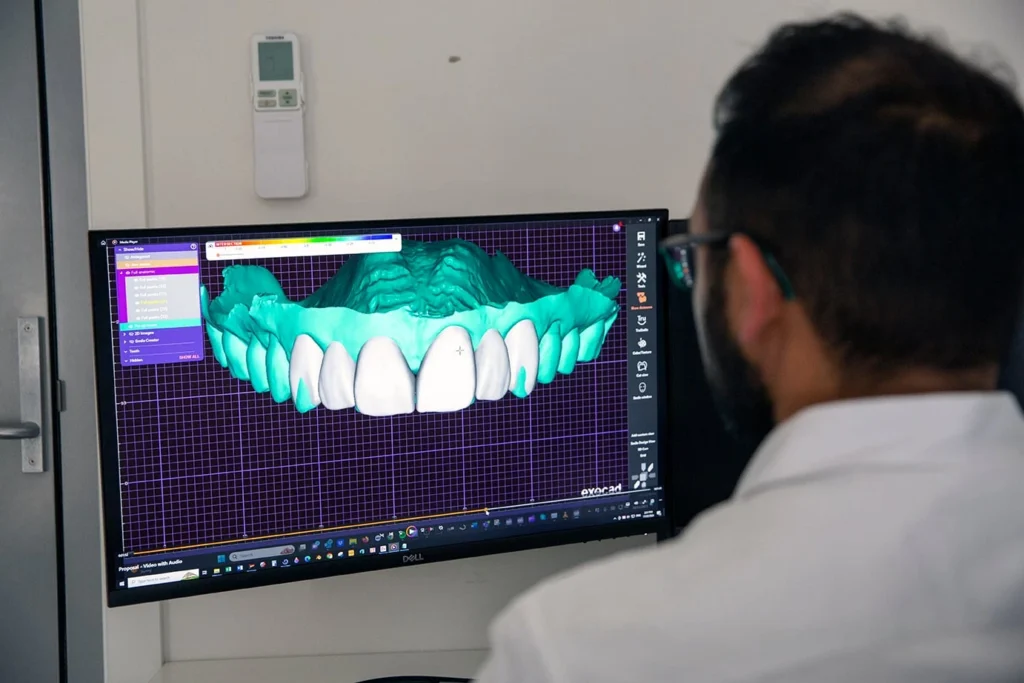 Cerec Same-day Crown Warragul
