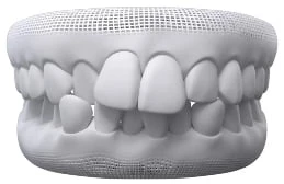 Crowded Teeth In Warragul, Gippsland In Warragul Dental Care