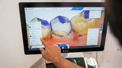 Crowns In One Appointment In Warragul, Gippsland In Warragul Dental Care