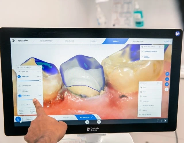 Dental Crowns And Bridges Near Warragul, Gippsland In Warragul Dental Care