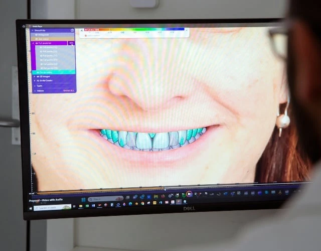 Dental Veneers In Warragul, Gippsland In Warragul Dental Care