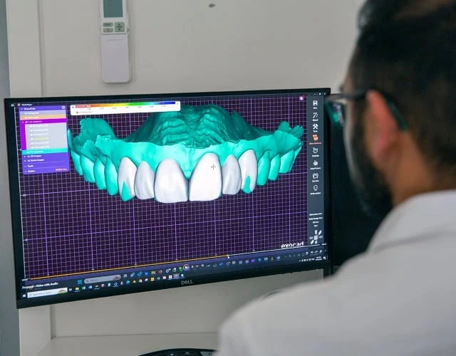Digital Smile Design In Warragul, Gippsland In Warragul Dental Care