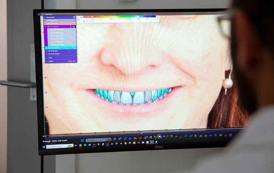 Digital Smile Design Process At Warragul, Gippsland In Warragul Dental Care