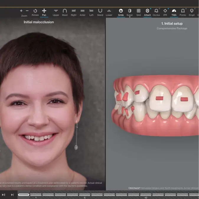 Invisalign Warragul Warragul Dental Care