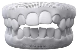 Openbite In Warragul, Gippsland In Warragul Dental Care