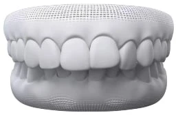 Overbite In Warragul, Gippsland In Warragul Dental Care