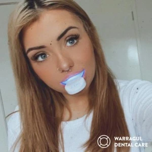 Pola Light For At-home Whitening Near Warragul, Gippsland In Warragul Dental Care