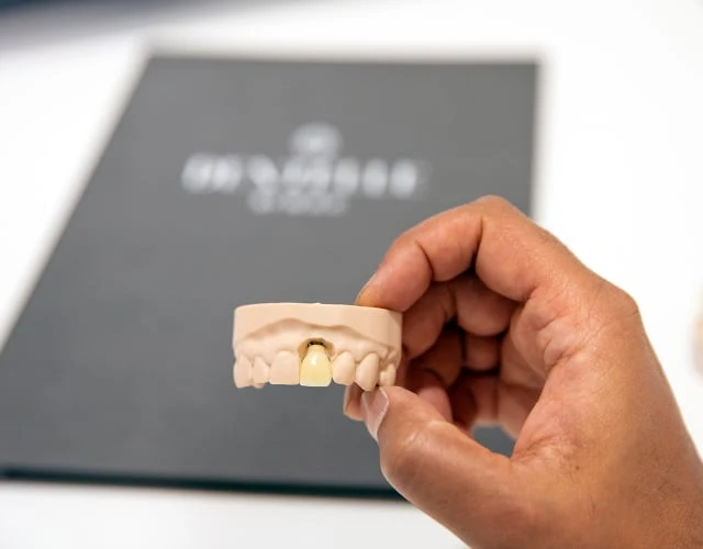 Problems Dental Implants Solve In Warragul, Gippsland At Warragul Dental Care