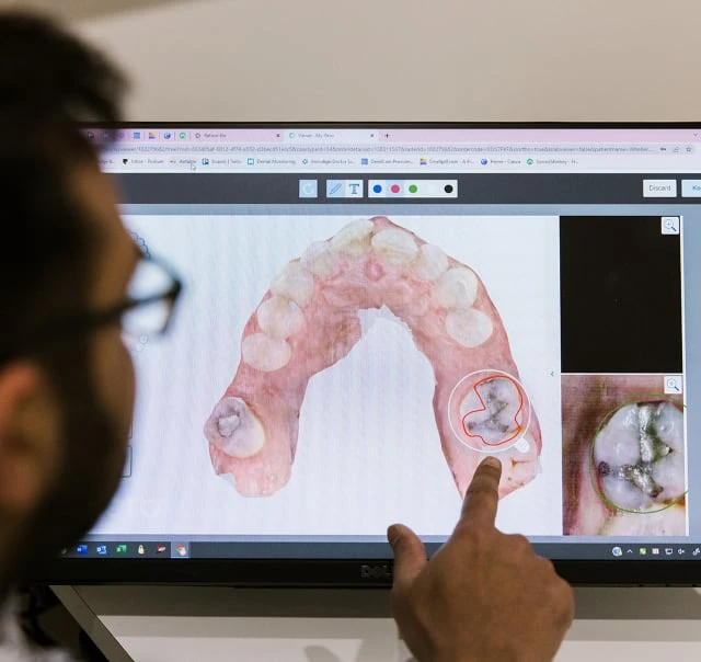 Problems Root Canal Therapy Solves In Warragul, Gippsland At Warragul Dental Care