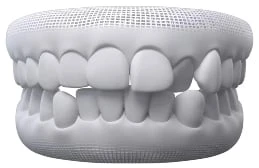 Straighter Teeth In Warragul, Gippsland In Warragul Dental Care