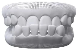 Under Bite In Warragul, Gippsland In Warragul Dental Care