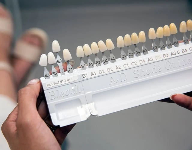 What Are Dental Veneers In Warragul, Gippsland At Warragul Dental Care
