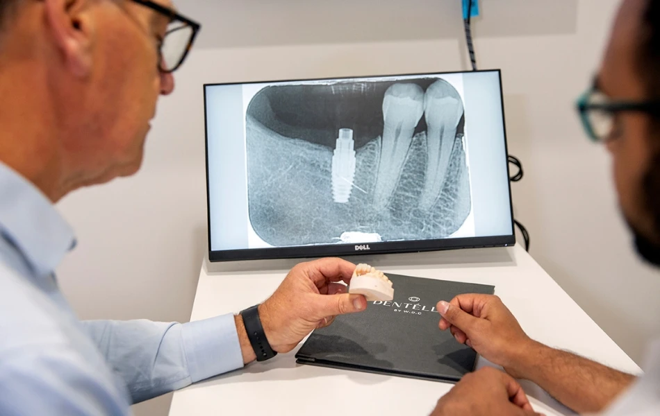 What Are Immediate Load And Delayed Load Implants? In Warragul, Gippsland At Warragul Dental Care