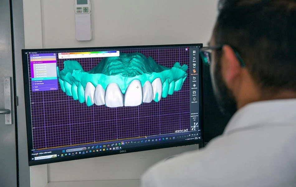 What Is a Digital Smile Design Near Warragul, Gippsland In Warragul Dental Care