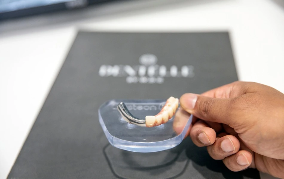What-Is-the-Process-of-All-on-X implants-Near-Warragul-Gippsland-In-Warragul-Dental-Care