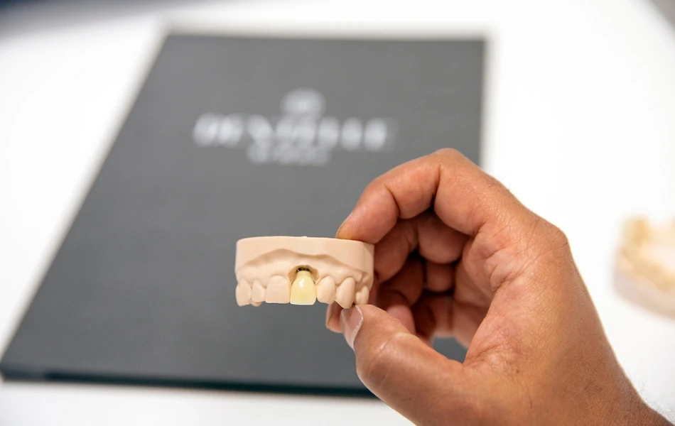 What’s The Best Way To Replace Multiple Missing Teeth? In Warragul, Gippsland At Warragul Dental Care