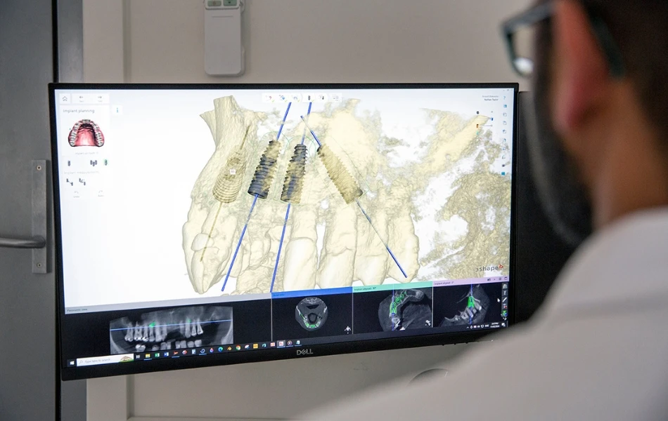 What’s The Difference Between Implant-supported Dentures And All-on-4 Implants? In Warragul, Gippsland At Warragul Dental Care
