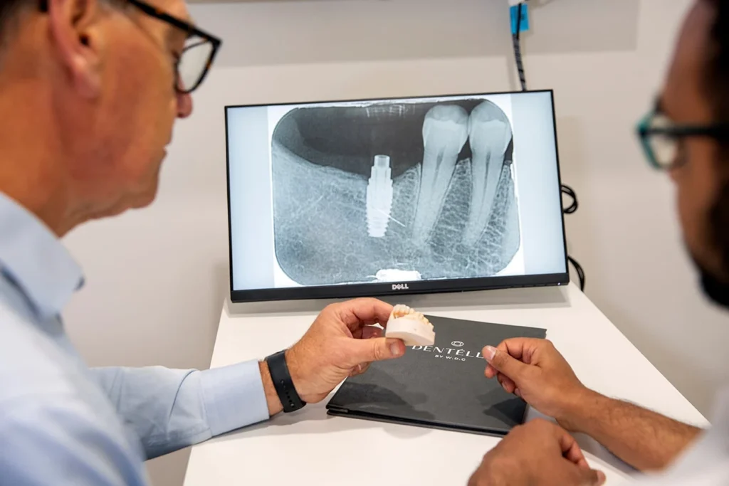 Dental Implants Vs Dentures Warragul